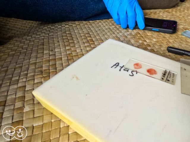 Blood Testing for Malaria in East Sumba by Fair Future